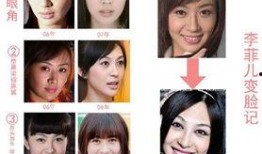 综艺明星整容爆料视频,整容真相大曝光！